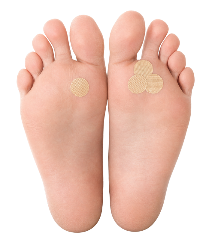 A pair of bare feet shown from the bottom, with small round beige adhesive patches applied to the sole of the left foot and three patches clustered on the sole of the right foot, against a plain white background.